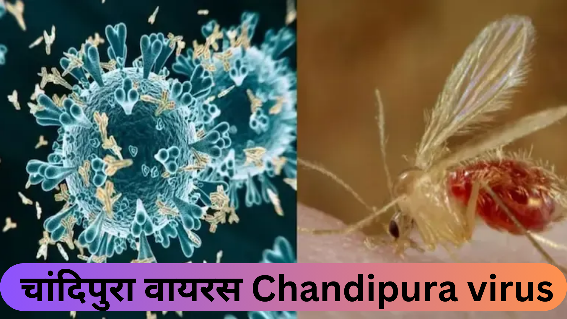 चांदिपुरा वायरस Chandipura virus 